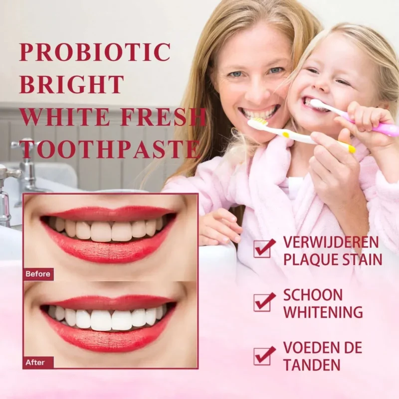 Yayashi SP-4 Probiotic Whitening Toothpaste - Teeth Whitening