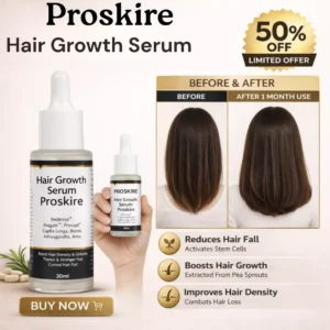 Proskire Hair Growth Serum – Reduces Hair Fall, Boosts Density, Activates Follicles – For Bald Patches, Receding Hairline & Thinning Hair